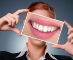 5 דברים שצריך לדעת לפני הלבנת שיניים