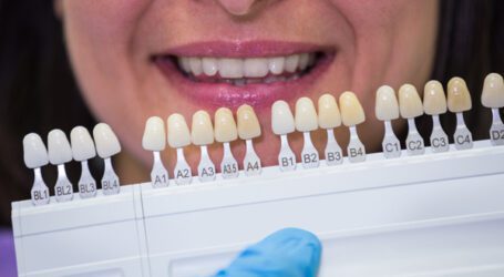 סוגי ציפויים לשיניים בטורקיה – לחיוך שלכם מגיע הטוב ביותר